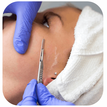 Glass skin dermaplaning treatment at Body Balance Hoboken spa.