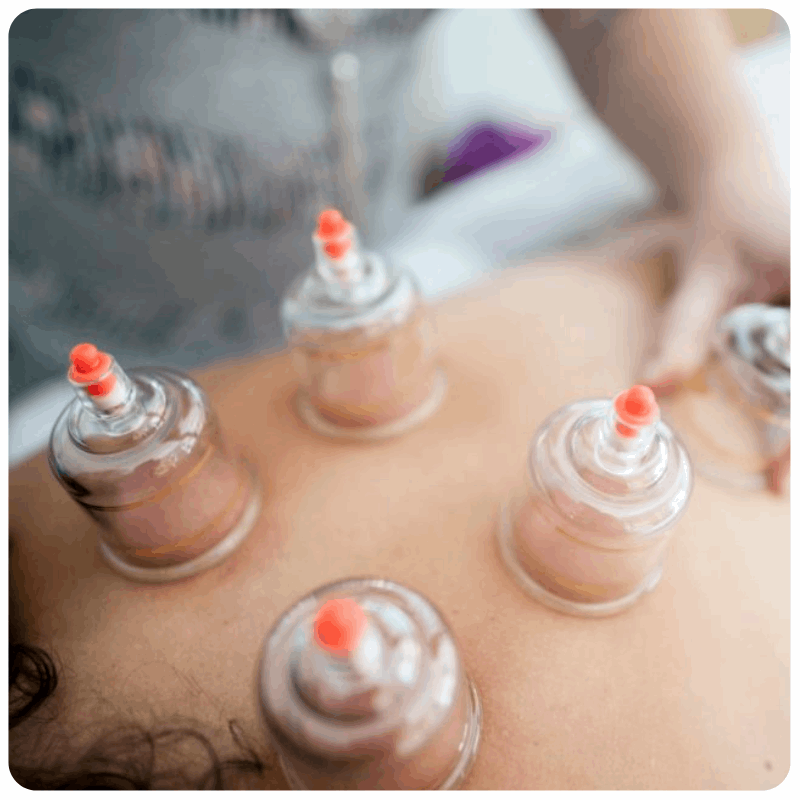 Cupping Therapy Massage